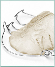 clear retainer